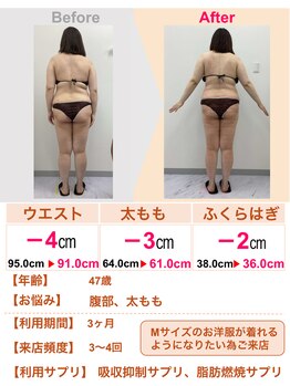 スリムステーション 草津(Slim Station)/腹部の影が薄く!!