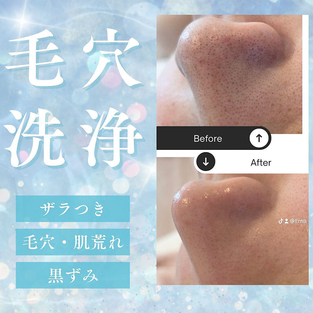 エステベッド　新品同様✨美品✨ 楽天市場】【P5倍!11.27 (木) 1:59まで】 フェイシャルベッド ロング