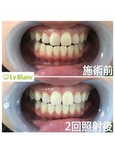 ルブラン 奈良店(Le Blanc)/確実な効果！