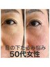 【40代・50代限定】即効実感!目の下たるみ改善フェイシャル