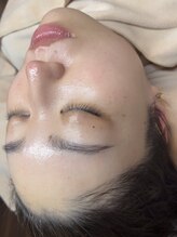 イーズ(eees)/ウルツヤ毛穴ケア12回目のお客様