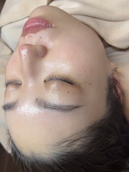 イーズ(eees)/ウルツヤ毛穴ケア12回目のお客様