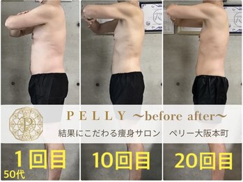 ペリー(PELLY)/男性50代　before after