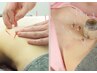 【梅雨時期限定】体の重だるさスッキリ!オーダーメイド全身鍼灸 60分