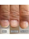 50代　形が悪い