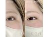 『美フォルムラッシュ☆』バラつかず、上向きキープマツパ8800円→ 7700円