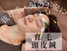 【メンズ限定】 髪の不安・抜け毛に◎ 育毛頭皮鍼