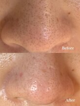 ウエカ(ueka)/30代　