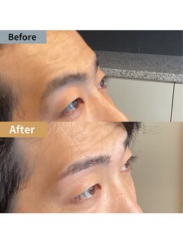 眉毛ハウス 吉祥寺店(眉毛HOUSE)/お客様の施術例(吉祥寺/東京)