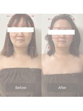天使の艶肌 武蔵小杉店/小顔矯正 before/after １