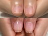 【トラブル爪にお悩みの方！】自爪育成コース(初回)