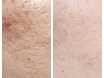 クリアー(CLEAR.)/【Before＆After】