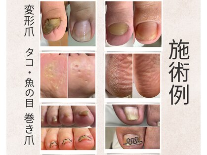 ランカ(RUNKA)の写真