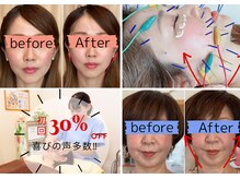 レフア 上北沢整体院の雰囲気（【美容鍼×微弱電流】5回～10回でリフトUP/たるみ改善/もち肌♪）