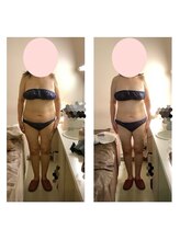 アクア エステティコ 亀有(ACQUA estetico)/脂肪燃焼　