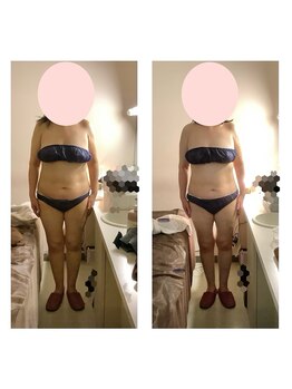 アクア エステティコ 亀有(ACQUA estetico)/脂肪燃焼　