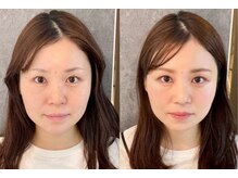 ルポナゴヤ(repos.nagoya)/【カラー＆顔タイプ診断】