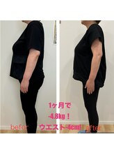 ヴェリテ(Verite)/before after