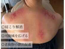 フウ(fuu.)/カッサ施術後