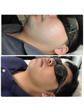 アプロディタ/きっとモテモテ♪