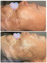 オーロラ(Aurora)/細胞が元気に♪♪