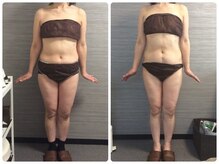 美容整体ウェリナ あま甚目寺院/小顔矯正/骨盤矯正/美脚サロン