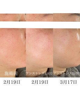 マール(MARL.)/クリスティーナトリートメント