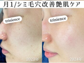 トリニエンス 新宿店(TRINIENCE)/30代/パーソナル改善ケア