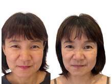 ナチュラルセラピー ドロップ(Drop)/５０代美容整体