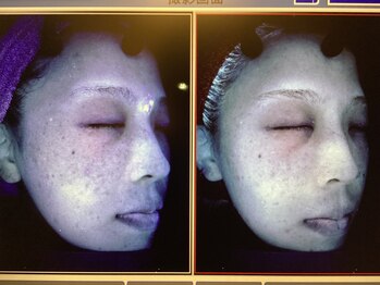 ポレポレ 八尾(polepole.)/ADSフェイシャルとホームケア