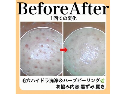 スイ(sui)の写真