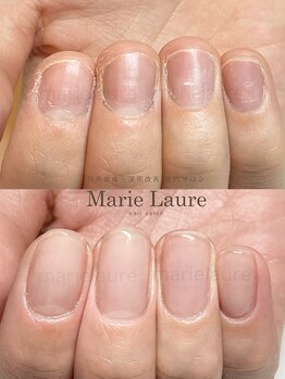 マリーロール 梅田店(Marie Laure)/深爪改善/自爪育成/ネイルケア