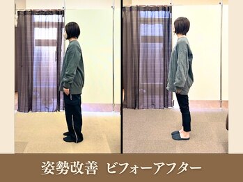 オリエンタル整体院 新潟院/40代 事務職 姿勢改善成果