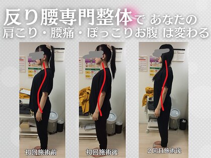 ストラボ 横浜店の写真