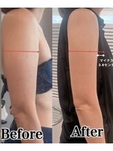 フレイヤビューティー スハダラボ 恵比寿(Freyia Beauty Suhada LABO)/-脂肪分解-