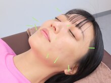 ネーム鍼灸整骨院 春日 本郷三丁目院/