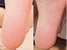 チカネイルミライ(Chika Nail ☆MIRAI★)