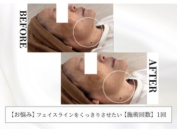 リリー 一宮店(Lily)/IT LIFT【60代】