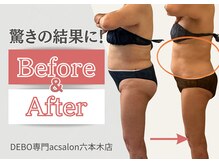 エーシーサロン 六本木店(acsalon)の雰囲気（食事制限なし月１遺伝子痩身と神サプリでウエスト-7.5cm[六本木]）