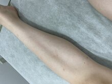 ナノハナ/鹿沼市全身脱毛美容室ナノハナ