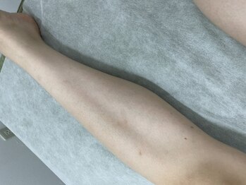 ナノハナ/鹿沼市全身脱毛美容室ナノハナ