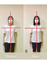 リトラ(Retra)/整体・BeforeAfter