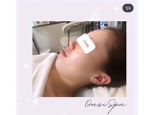 オアジスパ(Oasi Spa)/