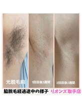 リオンズ 茨城ミスターマックス取手店/ツルスベワキをGETで快適に☆