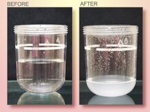 ジュリア オージェ 天王寺店/ビフォーアフター（鼻スパ）