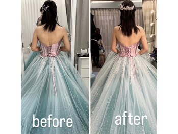 きれい塾 恵比寿/痩身【背中＆二の腕】