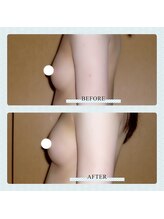 アップオー 小倉店(up・O)/体験者様　施術例