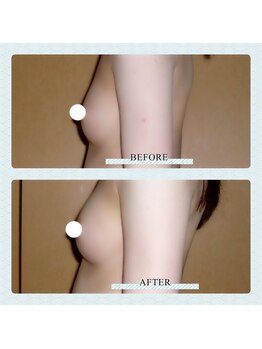 アップオー 小倉店(up・O)/体験者様　施術例