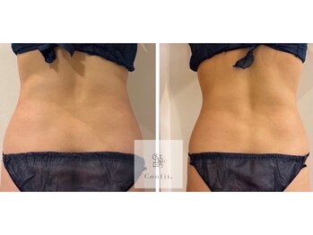 エムクリニカルラボ 藤沢(M clinical lab)/脂肪燃焼剤導入×痩身エステ