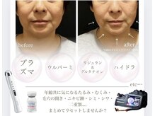 小顔ウナ学芸大学店(UNA)